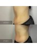 【便秘とストレスを溶かす】30分 温活腸もみ※腸診断は無いコースです