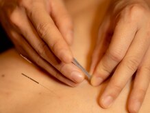 茅場町鍼灸マッサージ整骨院