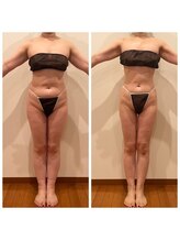 ワンモア(ONEMORE)/