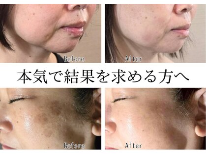 ビィーチェ(VIECE)の写真