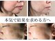 ビィーチェ(VIECE)の写真