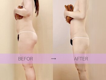 ピーエスアイ アネックス(PSi. annex)/神楽坂飯田橋エリア　痩身サロン