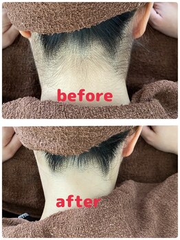 サロン シェリミー(Cheri mi)/うなじ脱毛