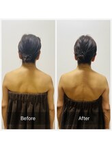 ヒール(heal)/【50代】肩こりのお悩み