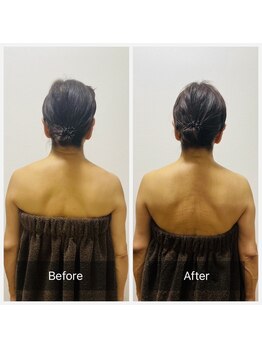 ヒール(heal)/【50代】肩こりのお悩み