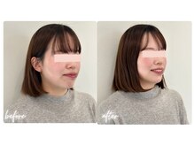 スタイルキューピット(style cupit)/メイクビフォアフター＊20代