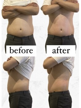 ビーアイリー(Be irie)/痩身エステ直後の変化