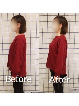 サロンリーベ(salon reve)/40代女性／肩、首こりでお悩み