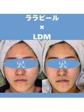 リスキン(Reskin)/《ツヤ、リフトアップ》