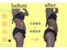 全身まるごと痩身◆脂肪冷却×キャビ吸引RF×よもぎ蒸し90分¥33000→8800円
