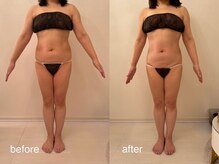 クロレ 浦和店(CLORE)/50代のお客様/9回施術