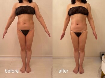 クロレ 浦和店(CLORE)/50代のお客様/9回施術