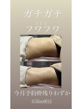 アディ(Adiy)/6月モニター様