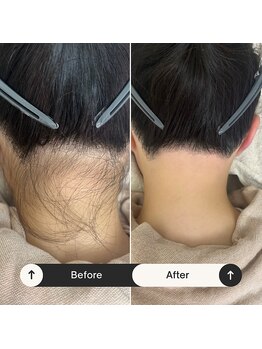 ワンダー(Wonder)/シュガーリング/うなじ美人