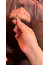 アルバ暁子鍼灸治療院(alba暁子鍼灸治療院)/刺さない鍼