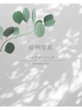 ミハン ボーテ(mihan.beaute)/