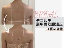 【二の腕｜痩身専門店】Esthetic Salon MillS 天神店/デコルテ肩甲骨矯正