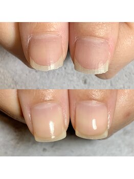 地爪ケアクリニックサロン 刈谷店の写真/爪の悩みさようなら!ジェルなし自爪育成&徹底ネイルケアで、自信あふれる指先へ☆