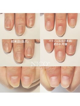 ニコプラス(NICO+)/自爪育成パラジェルクリア補強