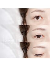 リヨン(LYON+831)/