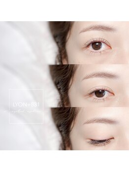 リヨン(LYON+831)/