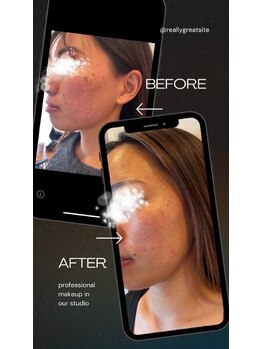 シエロ(Cielo)/陶肌トリートメント