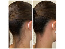 フリュ(Flux)の雰囲気（脱毛をはじめとするフェムケア、相談も丁寧に対応）