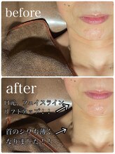 イーストモア(EAST MOIS)/首まで光を当てます☆