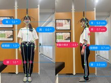 ナオル整体 大阪茨木院(NAORU整体)の雰囲気（【AI姿勢診断】before/afterで違いがわかる最新のAI技術を導入！）