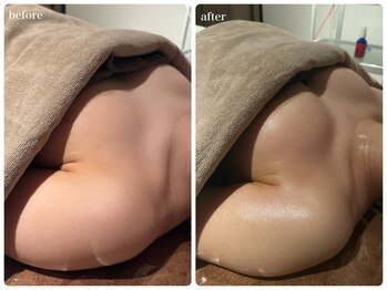 ビーグレイス(Vigrace)/バストパレット/首肩の凝りに◎