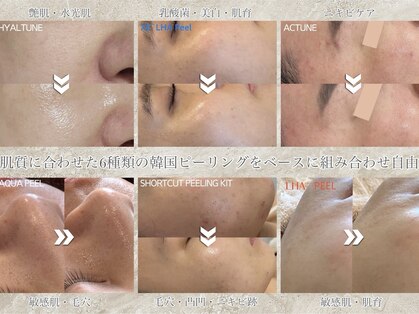 ウリ(uli beauty)の写真