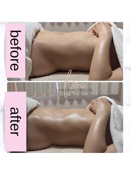 ルミライズヴィブリス(lumirise vibliss)/40代 腸もみ＋小顔矯正