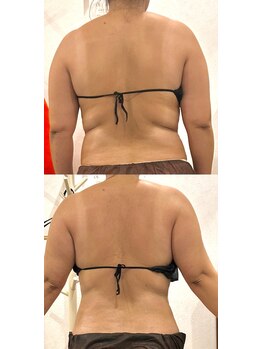 ルッカ(RUKKA)/【 腰周り 】ビフォーアフター