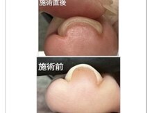 モエラニ(Moe Lani)の雰囲気（親指の違和感ありませんか？巻き爪ケアしなかがフットネイルも◎）