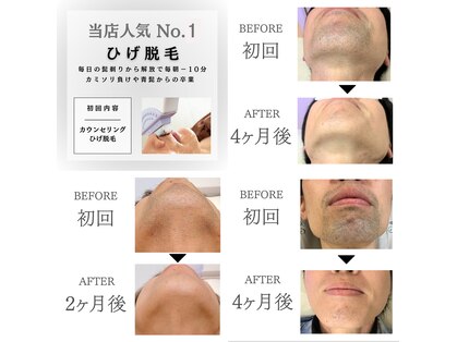 エクレ 今池店(EKURE)の写真