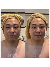 フフラ KANコルギセラピー山梨本店(fufla)/男性にも◎引き上がり効果！