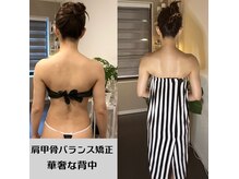 ソウ バイ ソウ(So by 蒼)の雰囲気(ブライダルエステ整体。4回↑肩幅-3cm/ゴツい背中/肩甲骨はがし)