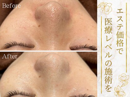 レア 姫路店(le'a)の写真