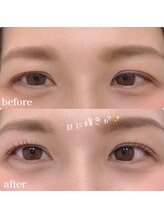 スープル アイ(SOUPLE.eye)/目に光が入ります！