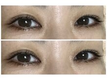 クリスタルボウ(Crystal BEAU)/ラッシュリフトまつげパーマ