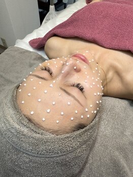 クロス(Xcross)の写真/【代官山エリア新導入】スピキュールダイヤ♪肌のターンオーバーを促進。肌の奥深くまで美容成分をお届け！