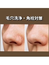 イージープラス つくば店(EASY+)/毛穴＆保湿ケア