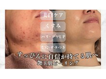 ビューティー サロン アズール(BEAUTY SALON AZUL)