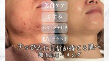 ビューティー サロン アズール(BEAUTY SALON AZUL)