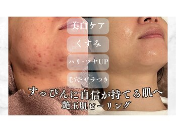 ビューティー サロン アズール(BEAUTY SALON AZUL)