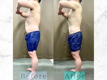 パラディ(PARADIS)/ハイパーナイフ/シェイプ