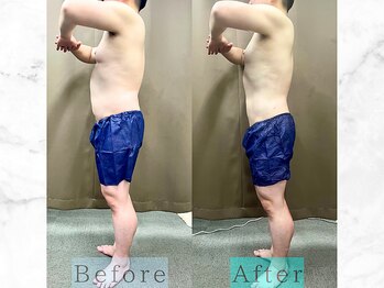 パラディ(PARADIS)/ハイパーナイフ/シェイプ