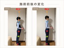 テラス 千葉(TERAS)の雰囲気（姿勢の軸を整えて、不調が再発しない身体作りも行います）