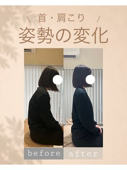 アオ 香椎(AO)/before→after