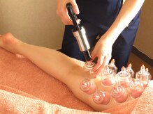 スイ(Sui)の雰囲気（浮腫みで重ダル足にもカッピングでスッキリ♪）